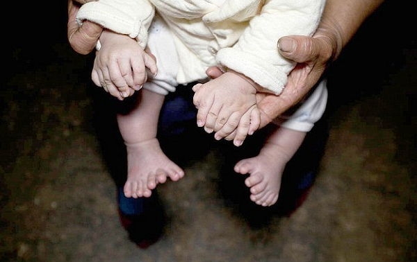 У трехмесячного китайского мальчика 15 пальцев на руках и 16 на ногах
