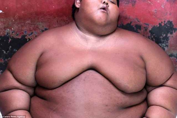 Самый полный мальчик в мире в 10 лет весит 192 кг 