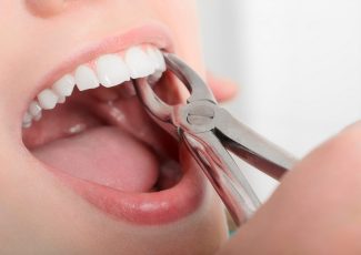 Удаление зубов: когда сохранение зуба невозможно
